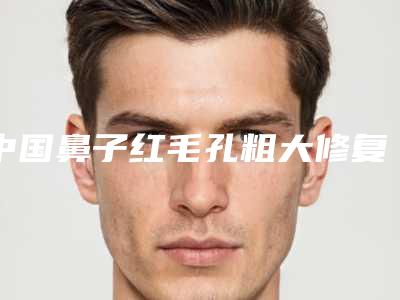 中国鼻子红毛孔粗大修复医院哪个比较好:鼻子红毛孔粗大修复医院50强经验丰富
